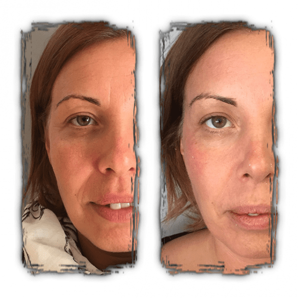 Crystal Clear COMCIT Before and After Definition Utopia