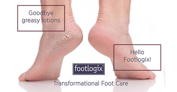 Footlogix